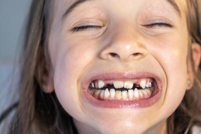 当今为何许多孩子有双排牙？分析常被忽略的原因