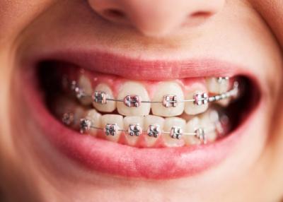 目前常用牙齿矫正有几种方法，九岁孩子牙齿反颌矫正的方法选择？