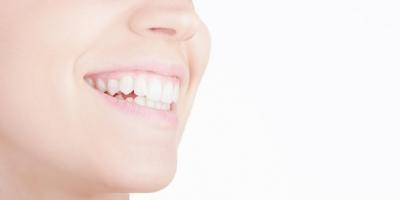 40岁整形牙齿矫正多少钱，年纪大牙齿整形的危害有哪些？