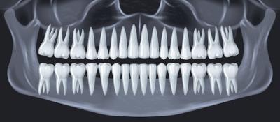 长沙做牙齿根管治疗多少钱，牙齿根管治疗后能用几年？