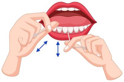 矫正牙齿后会不会影响吃东西？正畸后能吃什么？