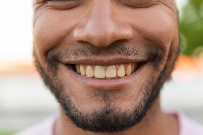 种植牙半口有几种方法？半口种植牙技术、优势及价格