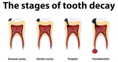 牙神经是什么形态图片，揭秘牙神经的真实形态