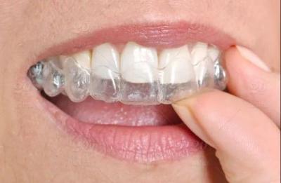 牙齿矫正两次会不会变松？多少岁不适合矫正牙齿？