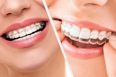 惠州矫正牙齿要多少钱？中年人矫正牙齿有危害吗？