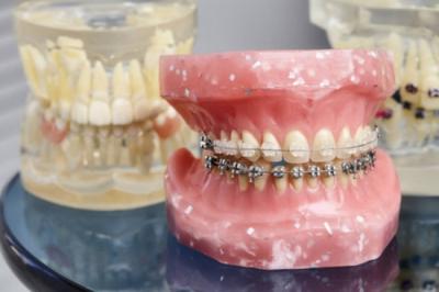 牙齿矫正医生重要吗？要怎么选择一个好的正畸医生？