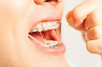 正畸小知识：牙齿矫正失败的原因有哪些？