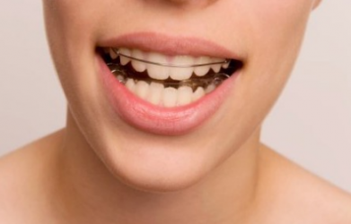正畸小知识：正畸时要怎么预防和减少牙根吸收的风险？