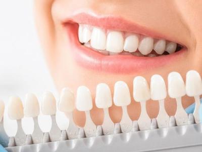 牙科小知识：牙齿贴面修复前后需要注意什么？