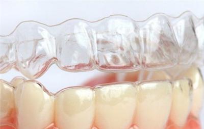 牙齿矫正怎么才要拔牙？儿童矫正牙齿拔牙有什么危害？