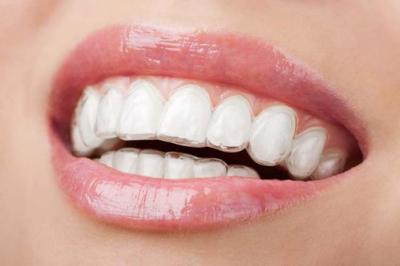 正畸科普：牙科医生在矫正牙齿时如何避免矫正过程中的风险？