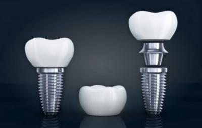 怎么判断种植牙是否安全？种植牙有哪些误区容易被误导？