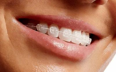 正畸小知识：拔牙矫正会对口腔健康产生哪些影响？