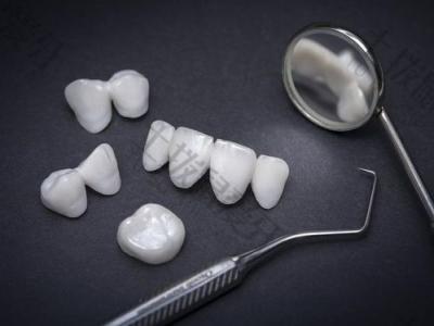 牙齿贴面能维持几年？牙齿贴面有什么好处与坏处？