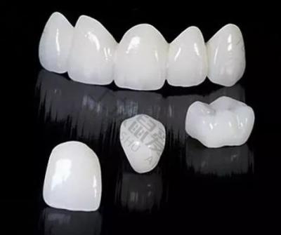 牙科小知识：烤瓷牙和全瓷牙哪个更适合后牙修复？