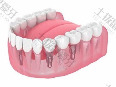 种牙会有什么风险吗？如何治疗种植牙术后的感染？