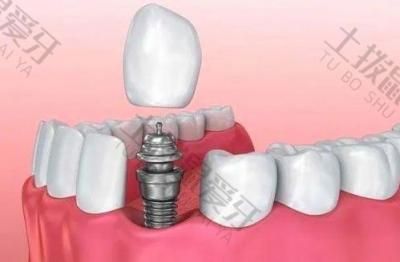 种植牙有哪些常见的术后并发症？如何预防种植牙术后并发症？