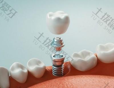 如何判断种植牙空间是否充足？种植牙会有副作用吗？