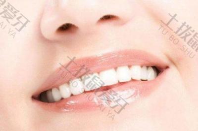 牙科小知识：银汞合金补牙和复合树脂补牙有哪些优缺点？