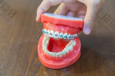 矫正牙齿有哪些要求？牙龈萎缩可以做牙齿矫正吗？