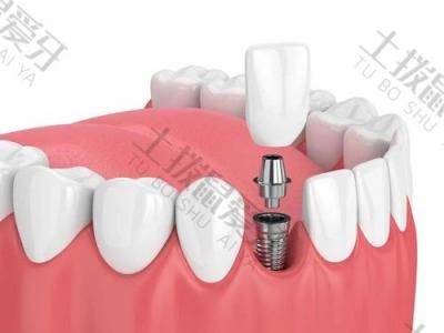 种植牙科普：种植体周围炎会对种植牙造成哪些危害？