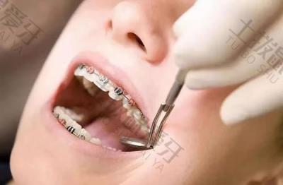 牙齿矫正去不正规医院会有哪些危害？矫正牙齿要如何挑选医院？