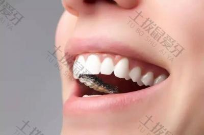 牙齿矫正出现黑三角的原因是什么？矫正牙齿出现黑三角要怎么处理？