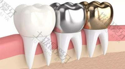 全瓷牙会伤害到其他牙齿吗？全瓷牙的效果如何？