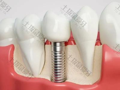 哪些因素会影响种植牙的成功率?如何评估种植牙的长期效果？