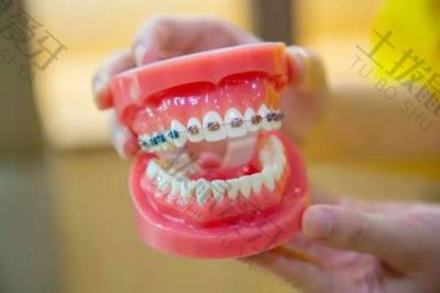 牙根吸收的原因有哪些？牙根吸收的程度要怎么判断？