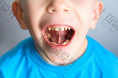 牙科小知识：对于不良口腔习惯，家长可以采取哪些干预措施？