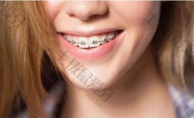正畸小知识：骨性牙矫正和牙性牙矫正有哪些区别？